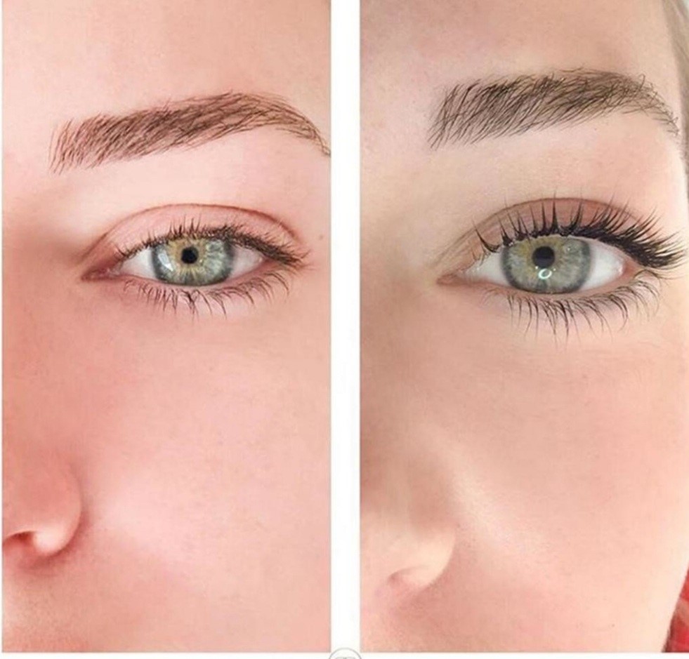 REHAUSSEMENT DES CILS Centre Médical Esthétique ALOHA